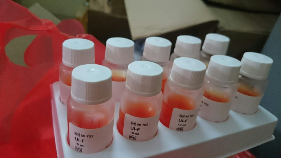 Thuốc thử Urea Indole Medium